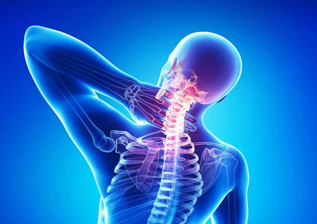 остеохондрозата е заболяване на гръбначния стълб