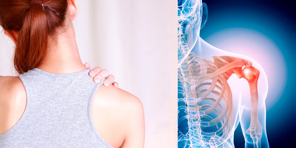 Развитието на остеоартрит на рамото постепенно води до постоянна болка