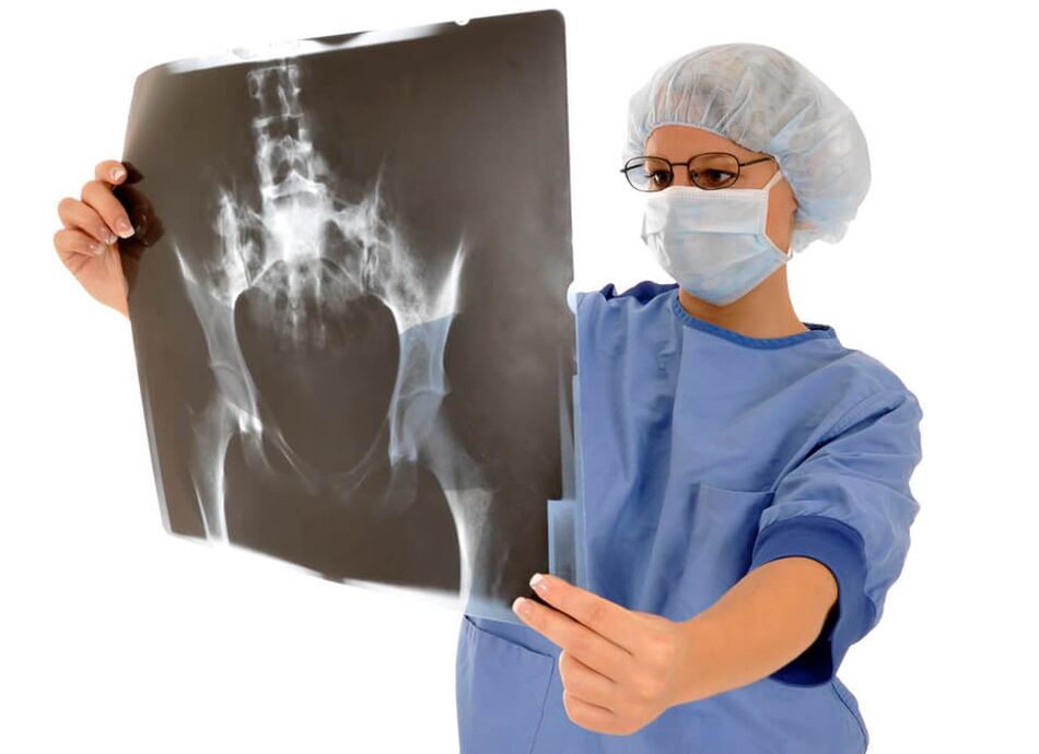 Рентгенографията на тазобедрената става ще помогне на лекаря да определи причината за болката